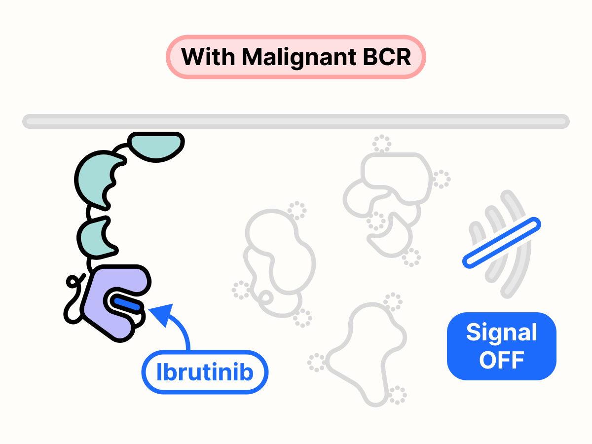 Ibrutinib blocks the ATP-binding site of BTK and stops growth signal transmission.